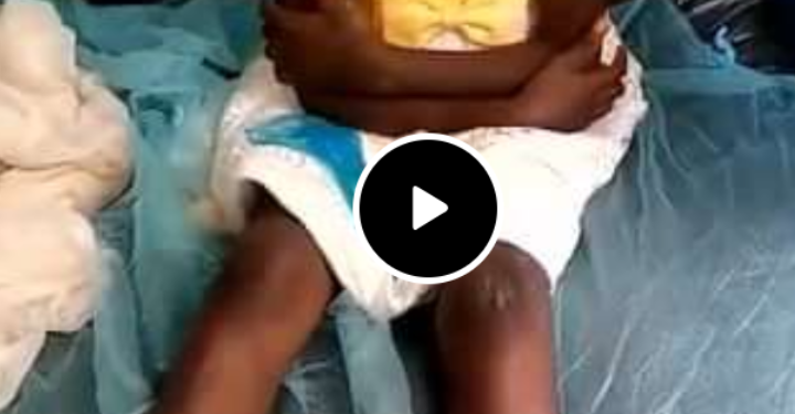 Cameroun: 10 ans, traumatisé, torturé, privé de nourriture pendant six mois par des parents à Yaoundé