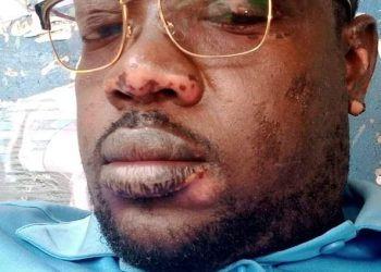 Tagne Noumessi Noel Andre with wounds all over the body after an attack