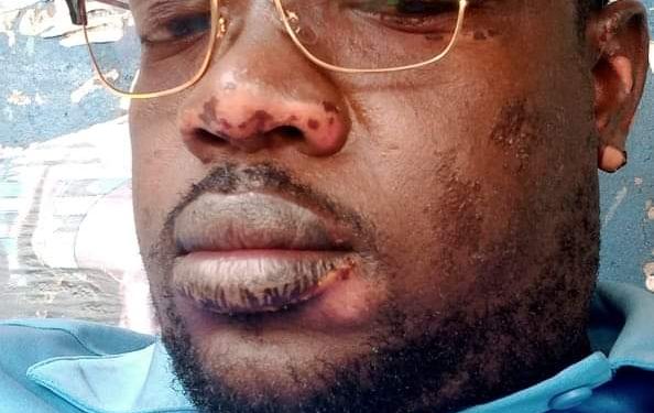 Tagne Noumessi Noel Andre with wounds all over the body after an attack