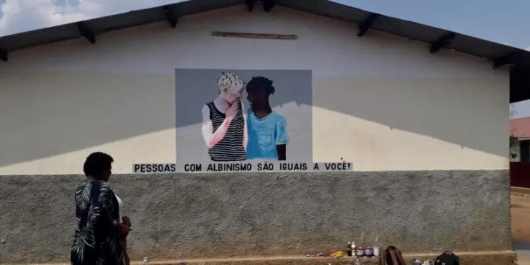 Breaking Educational Barriers for Children with Albinism