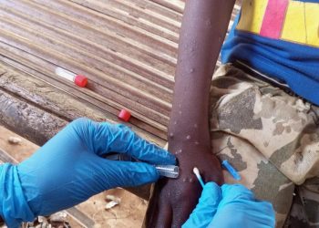 IOM Appeals for USD 18.5 Million to Urgently Aid Mpox-Affected Populations in East, Southern Africa